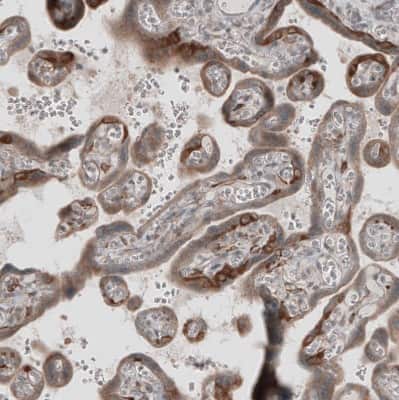 Immunohistochemistry-Paraffin: KANK4 Antibody [NBP1-89079] - Staining of human placenta shows moderate to strong cytoplasmic positivity in trophoblastic cells.