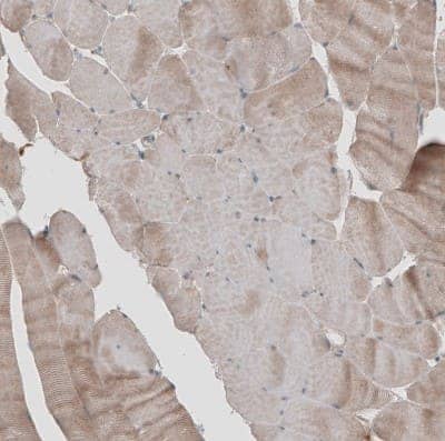 Immunohistochemistry-Paraffin: KANK4 Antibody [NBP1-89079] - Staining of human skeletal muscle shows weak positivity in myocytes as expected.