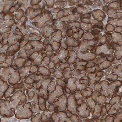 Immunohistochemistry-Paraffin: KANK4 Antibody [NBP1-89079] - Staining of human pancreas shows moderate to strong cytoplasmic positivity in exocrine glandular cells.