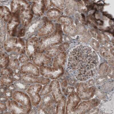 Immunohistochemistry-Paraffin: KANK4 Antibody [NBP1-89079] - Staining of human kidney shows moderate to strong cytoplasmic positivity in cells in tubules.
