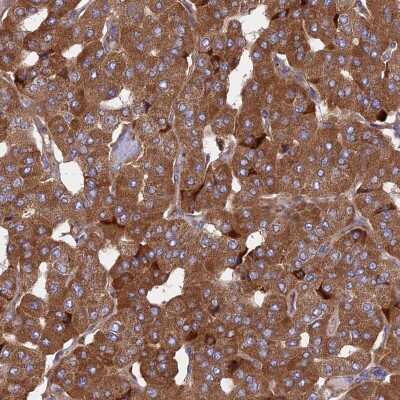 Immunohistochemistry-Paraffin: KANSL1L Antibody [NBP2-14796] - Staining of human parathyroid gland shows strong cytoplasmic positivity in glandular cells.