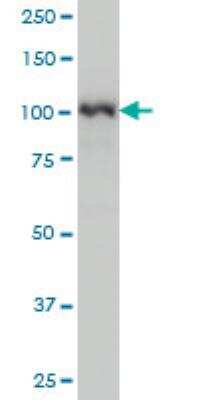 Western Blot: KAP1 Antibody (1D11) [H00010155-M02] - TRIM28 monoclonal antibody (M02), clone 1D11 Western Blot analysis of TRIM28 expression in Hela NE ( Cat # L013V3 ).