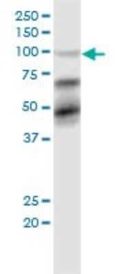 Western Blot: KAP1 Antibody (1D11) [H00010155-M02] - TRIM28 monoclonal antibody (M02), clone 1D11. Analysis of TRIM28 expression in MCF-7.