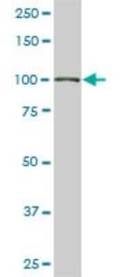 Western Blot: KAP1 Antibody (1D11) [H00010155-M02] - TRIM28 monoclonal antibody (M02), clone 1D11. Analysis of TRIM28 expression in NIH/3T3.