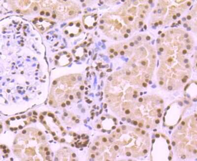 Immunohistochemistry-Paraffin: KAP1 Antibody (SD081-05) [NBP2-67786] - Analysis of paraffin-embedded human kidney tissue using anti-KAP1 antibody. Counter stained with hematoxylin.