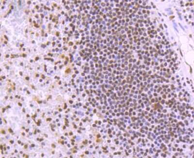 Immunohistochemistry-Paraffin: KAP1 Antibody (SD081-05) [NBP2-67786] - Analysis of paraffin-embedded human spleen tissue using anti-KAP1 antibody. Counter stained with hematoxylin.
