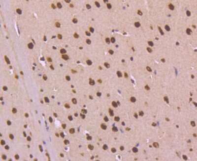 Immunohistochemistry-Paraffin: KAP1 Antibody (SD081-05) [NBP2-67786] - Analysis of paraffin-embedded mouse brain tissue using anti-KAP1 antibody. Counter stained with hematoxylin.