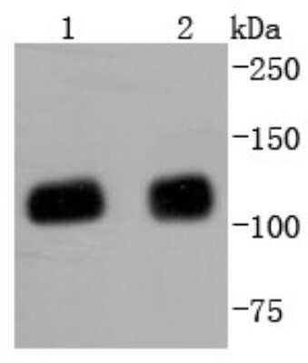 Western Blot: KAP1 Antibody (SD081-05) [NBP2-67786] - Analysis of KAP1 on different lysates using anti-KAP1 antibody at 1/1,000 dilution. Positive control: Lane 1: HepG2 Lane 2: Hela