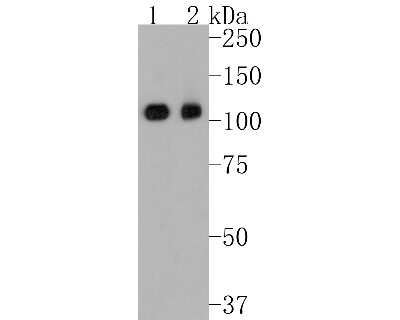 Western Blot: KAP1 Antibody (SD081-05) [NBP2-67786] - Western blot analysis of KAP1 on different lysates. Proteins were transferred to a PVDF membrane and blocked with 5% BSA in PBS for 1 hour at room temperature. The primary antibody (1/500) was used in 5% BSA at room temperature for 2 hours. Goat Anti-Rabb