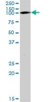 Western Blot: KAP1 Antibody [H00010155-B01P] - Analysis of TRIM28 expression in C32.