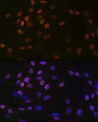 Immunocytochemistry/Immunofluorescence: KAT1 Antibody (7U2O3) [NBP3-16412] - Immunofluorescence analysis of C6 cells using KAT1 Rabbit mAb (NBP3-16412) at dilution of 1:100 (40x lens). Blue: DAPI for nuclear staining.