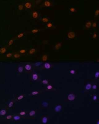 Immunocytochemistry/Immunofluorescence: KAT1 Antibody (7U2O3) [NBP3-16412] - Immunofluorescence analysis of NIH-3T3 cells using KAT1 Rabbit mAb (NBP3-16412) at dilution of 1:100 (40x lens). Blue: DAPI for nuclear staining.