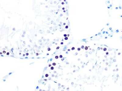 Immunohistochemistry-Paraffin: KAT1 Antibody (7U2O3) [NBP3-16412] - Immunohistochemistry of paraffin-embedded rat testis using KAT1 Rabbit mAb (NBP3-16412) at dilution of 1:100 (40x lens).Perform microwave antigen retrieval with 10 mM PBS buffer pH 7.2 before commencing with IHC staining protocol.