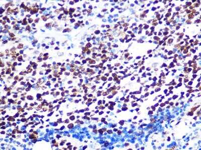 Immunohistochemistry-Paraffin: KAT1 Antibody (7U2O3) [NBP3-16412] - Immunohistochemistry of paraffin-embedded human appendix using KAT1 Rabbit mAb (NBP3-16412) at dilution of 1:100 (40x lens).Perform microwave antigen retrieval with 10 mM PBS buffer pH 7.2 before commencing with IHC staining protocol.