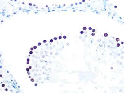 Immunohistochemistry-Paraffin: KAT1 Antibody (7U2O3) [NBP3-16412] - Immunohistochemistry of paraffin-embedded mouse testis using KAT1 Rabbit mAb (NBP3-16412) at dilution of 1:100 (40x lens).Perform microwave antigen retrieval with 10 mM PBS buffer pH 7.2 before commencing with IHC staining protocol.