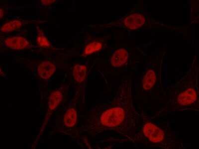 Immunocytochemistry/Immunofluorescence: KAT1 Antibody [NBP2-98803] - Immunofluorescence staining of KAT1 in HeLa cells. Cells were fixed with 4% PFA, blocked with 10% serum, and incubated with rabbit anti-human KAT1 polyclonal antibody (1:1000) at 4C overnight. Then cells were stained with the Alexa Fluor(R)594-conjugated Goat Anti-rabbit IgG secondary antibody (red). Positive staining was localized to nucleus.