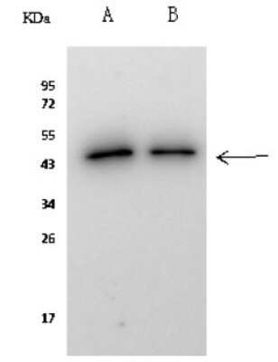 Immunoprecipitation: KAT1 Antibody [NBP2-98804] - KAT1 was immunoprecipitated using: Lane A: 0.5 mg HepG2 Whole Cell Lysate Lane B: 0.5 mg Jurkat Whole Cell Lysate 2 ul anti-KAT1 rabbit polyclonal antibody and 60 ug of Immunomagnetic beads Protein A/G.  Primary antibody: Anti-KAT1 rabbit polyclonal antibody, at 1:100 dilution. Secondary antibody: Clean-Blot IP Detection Reagent (HRP) at 1:1000dilution  Developed using the ECL technique. Performed under reducing conditions. Predicted band size: 49 kDa. Observed band size: 49 kDa