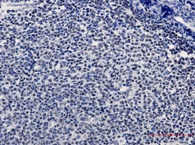 Immunohistochemistry-Paraffin: KAT1 Antibody (S04-3G4) [NBP3-19521] - Immunohistochemistry of KAT1/HAT1 in paraffin-embedded Human tonsil using KAT1/HAT1 Rabbit mAb at dilution 1/50