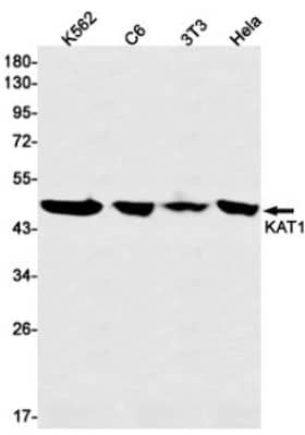 Western Blot: KAT1 Antibody (S04-3G4) [NBP3-19521] - Western blot detection of KAT1/HAT1 in K562, C6, 3T3, Hela cell lysates using KAT1/HAT1 Rabbit mAb (1:1000 diluted). Predicted band size: 50kDa. Observed band size: 45kDa.