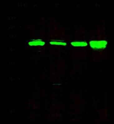 Western Blot: KAT1 Antibody [NBP2-98803] - Anti-KAT1 rabbit polyclonal antibody at 1:500 dilution. Lane A: Jurkat Whole Cell Lysate. Lane B: K562 Whole Cell Lysate. Lane C: HepG2 Whole Cell Lysate. Lane D: U87MG Whole Cell Lysate. Lysates/proteins at 30 ug per lane. Secondary Goat Anti-Rabbit IgG H&L (Dylight 800) at 1/10000 dilution. Developed using the Odyssey technique. Performed under reducing conditions. Predicted band size: 49 kDa. Observed band size: 49 kDa