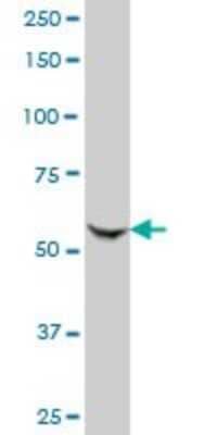 Western Blot: KAT2A/GCN5 Antibody (3F8) [H00002648-M06] - Analysis of GCN5L2 expression in RIN-m5F.