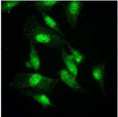 Immunocytochemistry/Immunofluorescence: KAT2A/GCN5 Antibody (3G13) [NBP1-48593] - HeLa cells were stained by monoclonal anti-human GCN5L2 antibody (1:500) with Alexa 488 (Green).