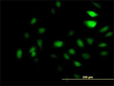 Immunocytochemistry/Immunofluorescence: KAT2A/GCN5 Antibody (4D3) [H00002648-M01] - Analysis of monoclonal antibody to GCN5L2 on HeLa cell. Antibody concentration 10 ug/ml.