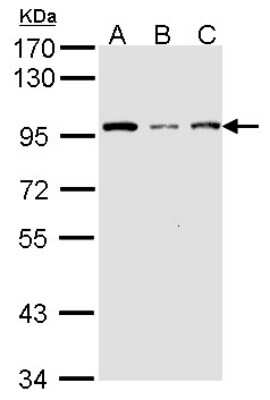 Western Blot: KAT2A/GCN5 Antibody [NBP2-17018] - Sample (30 ug of whole cell lysate) A: A431 B: H1299 C: Hela 7. 5% SDS PAGE gel, diluted at 1:1000.