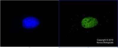 Immunocytochemistry/Immunofluorescence: KAT3B/p300 Antibody (RW105) - Azide and BSA Free [NBP2-80820] - HeLa cells were fixed in 4% paraformaldehyde for 10 min and permeabilized in 0.05% Triton X-100 in PBS for 5 minutes. The cells were incubated with anti-KAT3B Antibody (RW105)) at 5ug/ml for 60 minutes at room temperature and detected with an anti-mouse Dylight 488 (Green) at a 1:1000 dilution for 60 minutes. Nuclei were counterstained with DAPI (Blue). Cells were imaged using a 100X objective. Image from the standard format of this antibody.