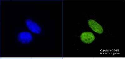 Immunocytochemistry/Immunofluorescence: KAT3B/p300 Antibody (RW128) - Azide and BSA Free [NBP2-80819] - HeLa cells were fixed in 4% paraformaldehyde for 10 min and permeabilized in 0.05% Triton X-100 in PBS for 5 minutes. The cells were incubated with anti-KAT3B Antibody (RW128) at 5 ug/ml for 60 minutes at room temperature and detected with an anti-mouse Dylight 488 (Green) at a 1:1000 dilution for 60 minutes. Nuclei were counterstained with DAPI (Blue). Cells were imaged using a 100X objective. Image from the standard format of this antibody.