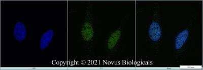 Immunocytochemistry/Immunofluorescence: KAT3B/p300 Antibody (RW128) - Azide and BSA Free [NBP2-80819] - HeLa cells were fixed in 4% paraformaldehyde for 10 minutes and permeabilized in 0.5% Triton X-100 in PBS for 5 minutes. The cells were incubated with anti-KAT3B/p300 Antibody (RW128) NBP2-80819 at 2 ug/ml overnight at 4C and detected with an anti-mouse Dylight 488 (Green) at a 1:1000 dilution for 60 minutes. Nuclei were counterstained with DAPI (Blue). Cells were imaged using a 100X objective and digitally deconvolved.