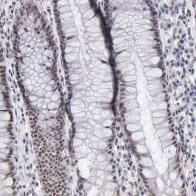 Immunohistochemistry-Paraffin: KAT4/TBP Associated Factor 1 Antibody [NBP1-90036] - Staining of human rectum shows nuclear positivity in glandular cells.