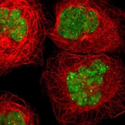 <b>Orthogonal Strategies Validation. </b>Immunocytochemistry/Immunofluorescence: KAT6B-MORF Antibody [NBP1-92036] - Staining of human cell line A-431 shows localization to nucleus & nuclear bodies. Antibody staining is shown in green.