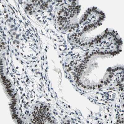 Immunohistochemistry-Paraffin: KAT6B-MORF Antibody [NBP1-92036] - Staining of human fallopian tube shows moderate to strong nuclear positivity in glandular cells.