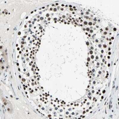 Immunohistochemistry-Paraffin: KAT6B-MORF Antibody [NBP1-92036] - Staining of human testis shows moderate to strong nuclear positivity in cells in seminiferous ducts.