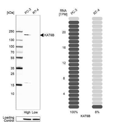 Western Blot: KAT6B-MORF Antibody [NBP1-92036] - Analysis in human cell line PC-3 and human cell line RT-4.