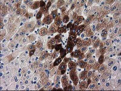 Immunohistochemistry-Paraffin: KATNAL1 Antibody (1A7) [NBP2-03555] - Staining of paraffin-embedded Human liver tissue using anti-KATNAL1 mouse monoclonal antibody.