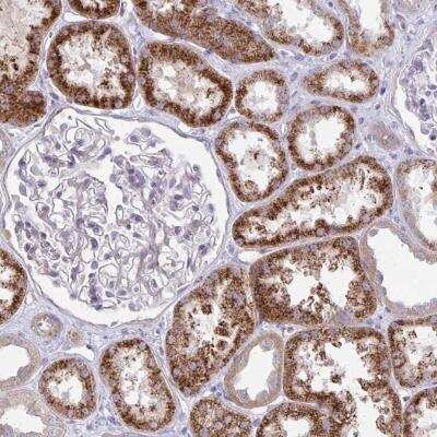 Immunohistochemistry-Paraffin: KATNBL1 Antibody [NBP2-31859] - Staining of human kidney shows strong cytoplasmic positivity in cells in tubules.