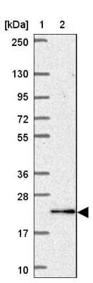 Western Blot: KATNBL1 Antibody [NBP2-31859] - Lane 1: Marker  [kDa] 250, 130, 95, 72, 55, 36, 28, 17, 10.  Lane 2: Human cell line RT-4