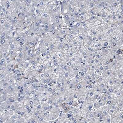 Immunohistochemistry-Paraffin KBTBD10 Antibody - BSA Free