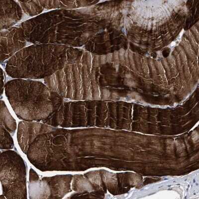 Immunohistochemistry-Paraffin KBTBD10 Antibody - BSA Free
