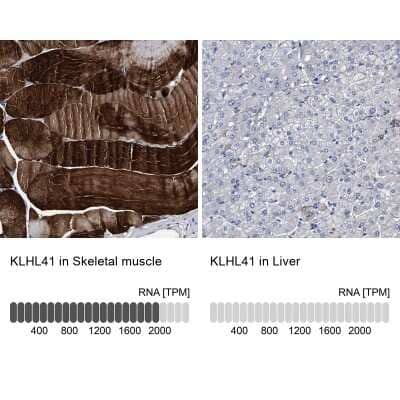 Immunohistochemistry-Paraffin KBTBD10 Antibody - BSA Free
