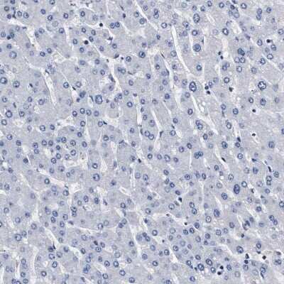 Immunohistochemistry-Paraffin: KBTBD10 Antibody [NBP1-80787] - Staining of human liver shows low expression as expected.