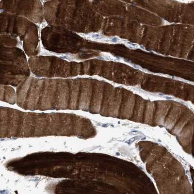 Immunohistochemistry-Paraffin: KBTBD10 Antibody [NBP1-80787] - Staining of human skeletal muscle shows high expression.