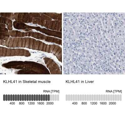 Immunohistochemistry-Paraffin: KBTBD10 Antibody [NBP1-80787] - Staining in human skeletal muscle and liver tissues using anti-KLHL41 antibody. Corresponding KLHL41 RNA-seq data are presented for the same tissues.