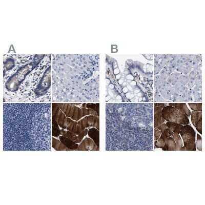 <b>Independent Antibodies Validation and Orthogonal Strategies Validation.</b>Immunohistochemistry-Paraffin: KBTBD10 Antibody [NBP1-80787] - Staining of human colon, liver, lymph node and skeletal muscle using Anti-KLHL41 antibody NBP1-80787 (A) shows similar protein distribution across tissues to independent antibody NBP1-80786 (B).