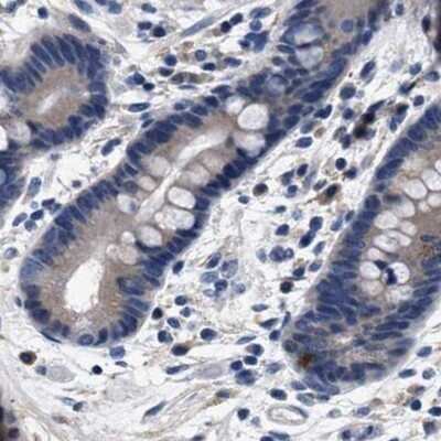 Immunohistochemistry-Paraffin: KBTBD10 Antibody [NBP1-80787] - Staining of human colon.