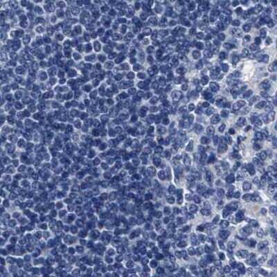 Immunohistochemistry-Paraffin: KBTBD10 Antibody [NBP1-80787] - Staining of human lymph node.
