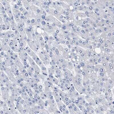 Immunohistochemistry-Paraffin: KBTBD10 Antibody [NBP1-80788] - Staining of human liver shows low expression as expected.