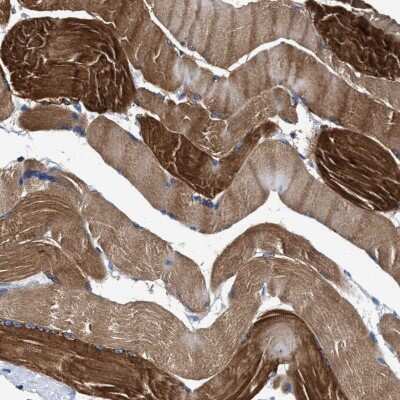 Immunohistochemistry-Paraffin: KBTBD10 Antibody [NBP1-80788] - Staining of human skeletal muscle shows high expression.
